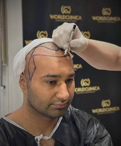 Hairline Design